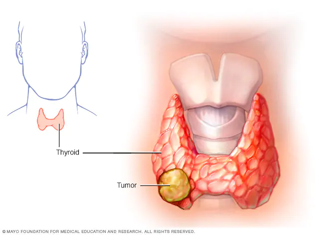 Thyroid gland diagram